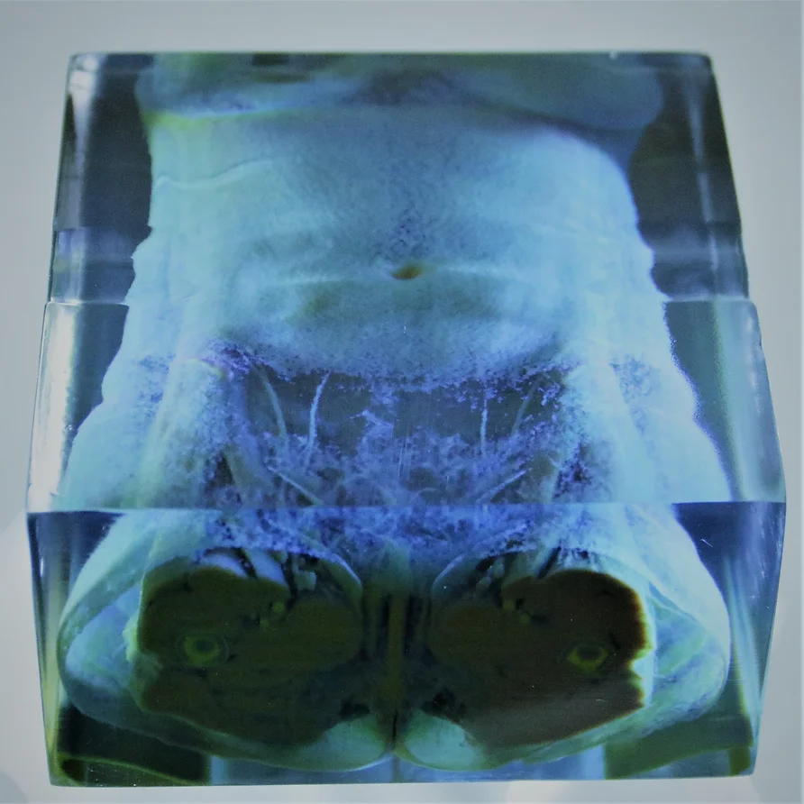 Presurgical Planning Models